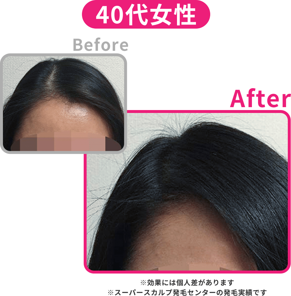 40代女性の髪の変化